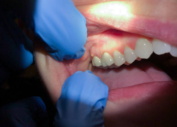 Best Dentist for Dental Trauma  in Waverly, IL