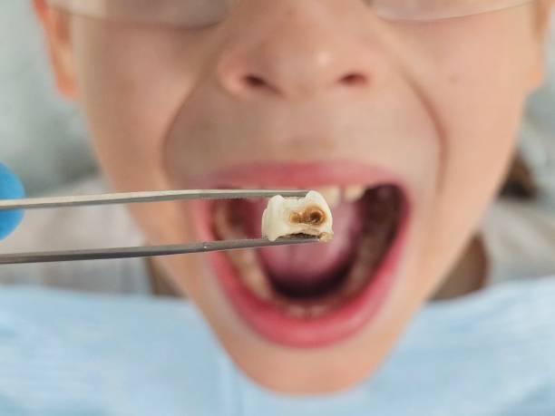 Best Emergency Gum Pain Relief  in Waverly, IL