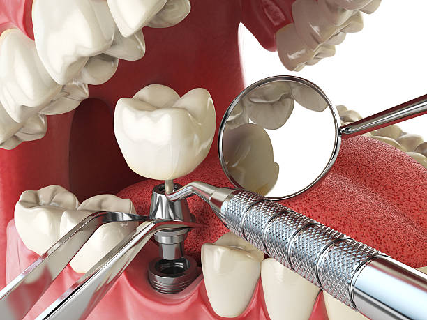 Best Emergency Tooth Extraction  in Waverly, IL